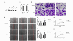  Lipopolysaccharide promotes bladder cancer immunosuppression by disrupting the Tfh/Tfr balance through TLR4 signaling